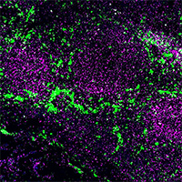 Stained immune cells from the blood of a human being